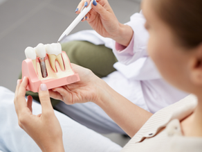 Dentures and Implants Timeline - An Overview