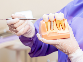 Implant Dentures: A Smile Solution That Sticks!