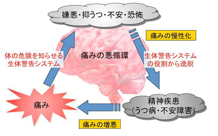 痛み、抑うつの悪循環.jpg