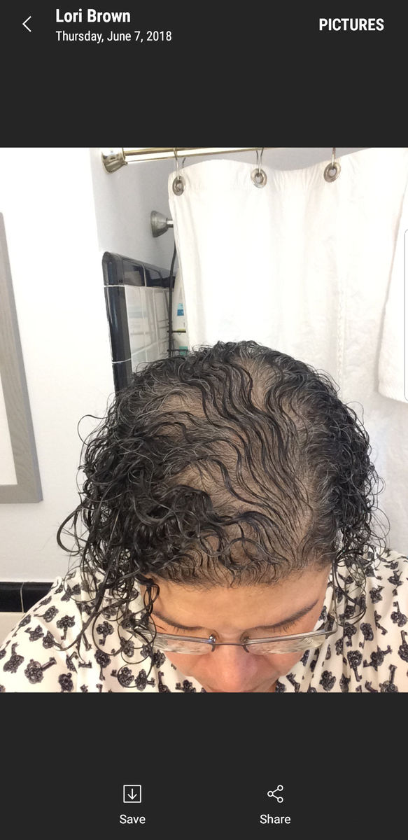 Hair Alexander's