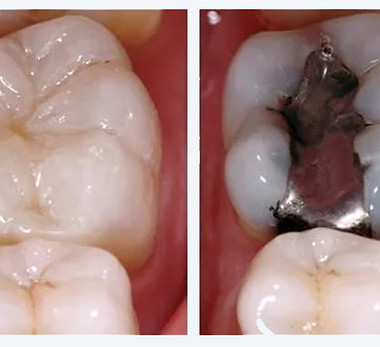 0-operatoria-dental-villasonrisas-a3.jpg