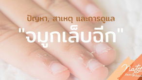 จัดการ "จมูกเล็บฉีก โคนเล็บลอก" ปัญหากวนใจคนรักเล็บ