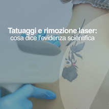 Tatuaggi e rimozione laser: cosa dice l'evidenza scientifica