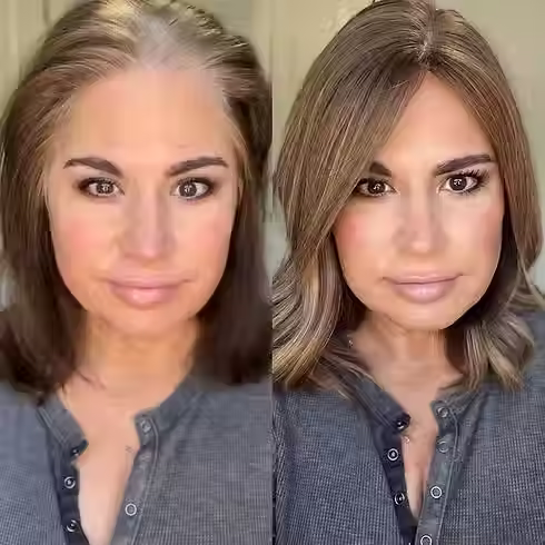 NON SURGICAL WIG HAIR SOLUTION REPLACEMENT