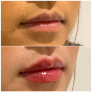 Lips8.jpeg