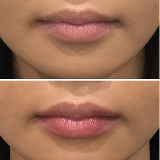 Lips11.jpeg