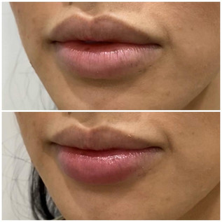 Lips1.jpeg