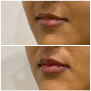 Lips9.jpeg