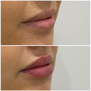 Lips2.jpeg