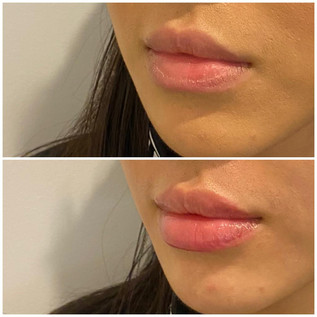 Lips4.jpeg