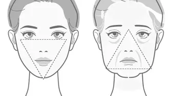 The triangle of youth. How ageing leads to jowls
