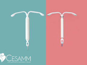 DIU hormonal Kyleena e Mirena, qual a diferença?