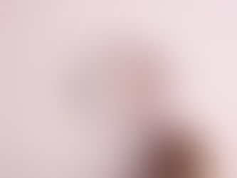 O que fazer em casos de candidíase recorrente?