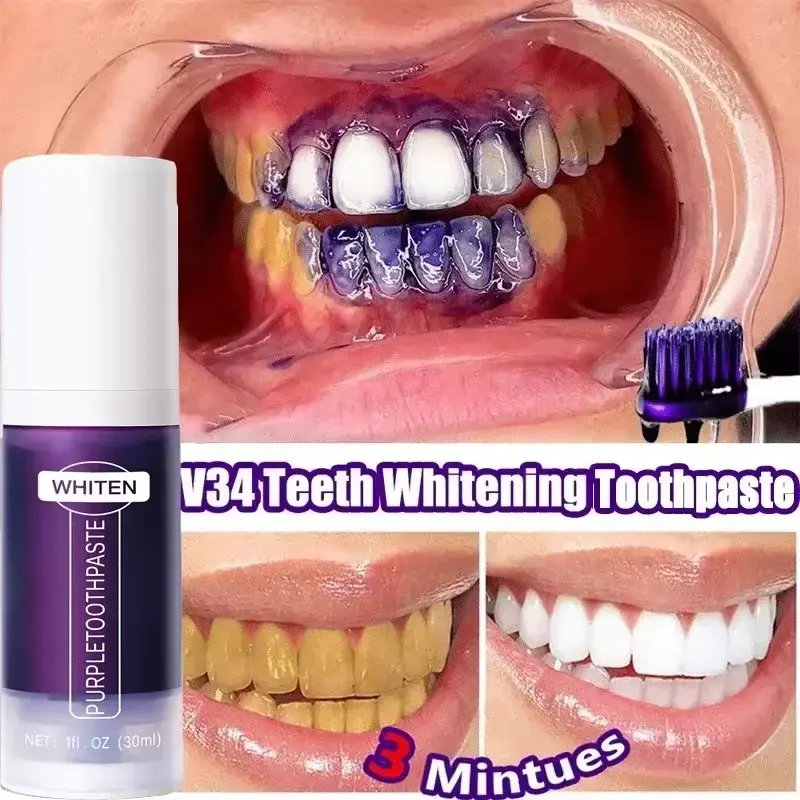 Thumbnail: Audacci V34 BrightSmile Toothpaste