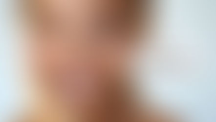 Achieve Beautiful, Personalized Results with Aesthetic Treatments