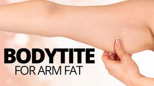 BodyTite for Reducing Arm Fat