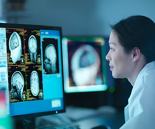 Médico analizando escáneres cerebrales