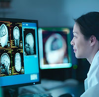 Médico analisando exames cerebrais