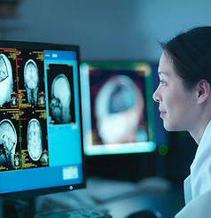 Doctor analyzing brain scans