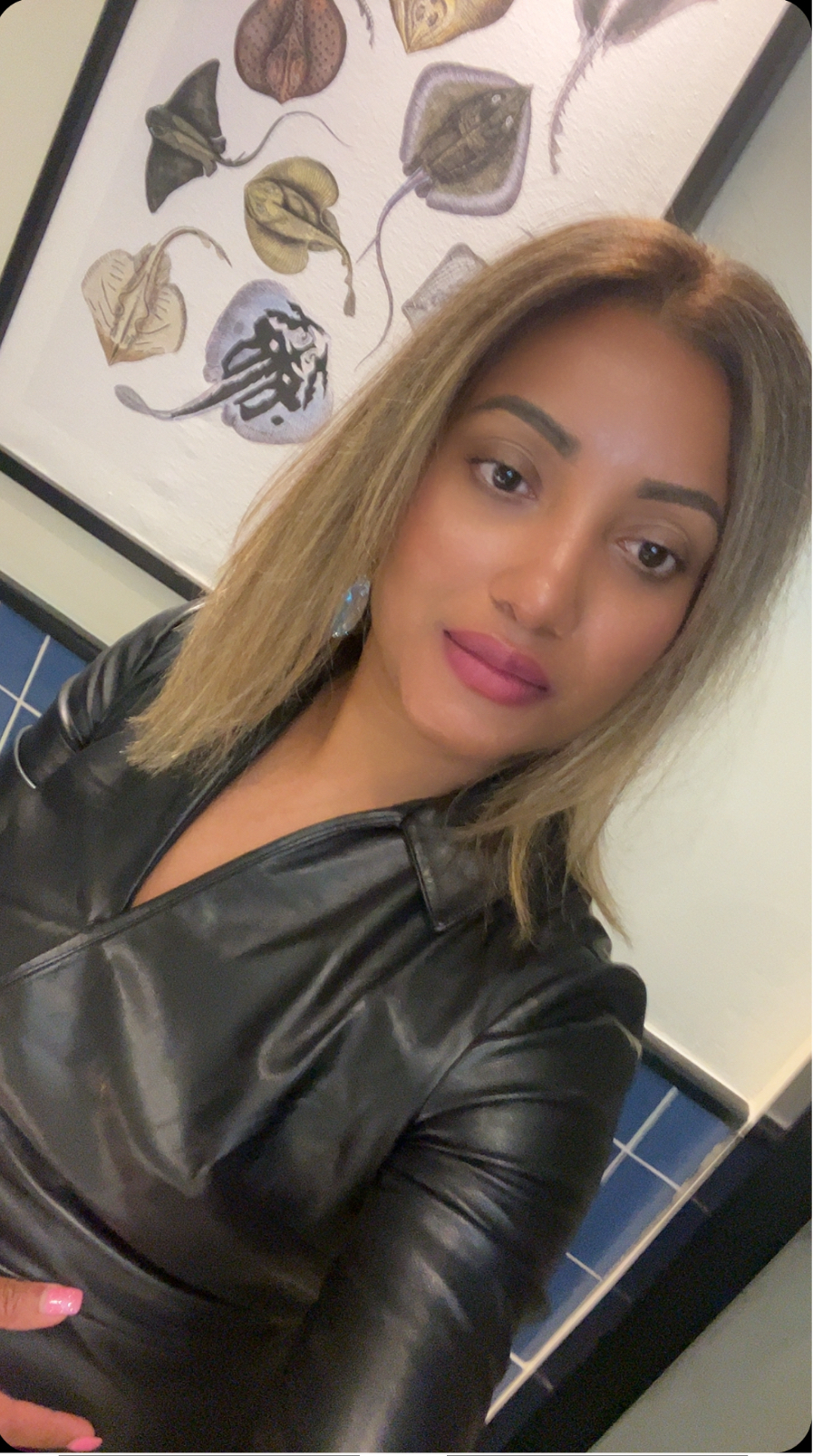 Writer: MindBodyBeauty Aesthetics 