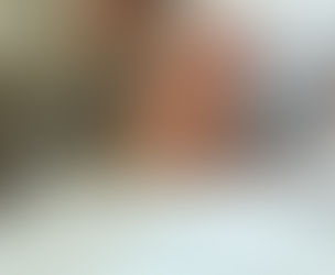 Benefits of Microneedling and Microdermabrasion at MindBodyBeauty Aesthetics, the only Facial Spa that offers both treatments in one session to provide optimal results for clients.