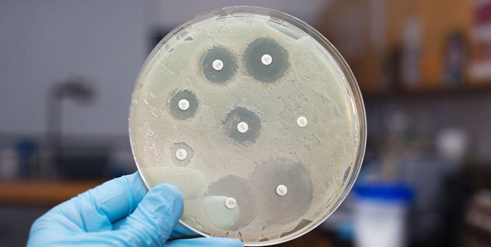 Antibiograma (Teste de Susceptibilidade a Antimicrobianos)