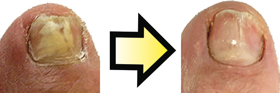 ree