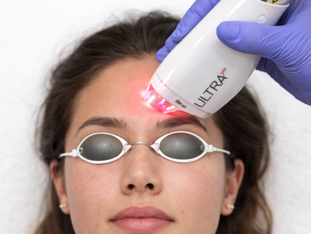 Laser Level 1, 2, 3: Which Skin Rejuvenation Level Is Right for You?