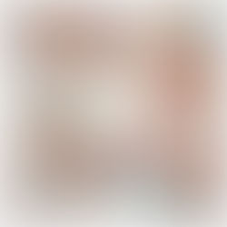 Why Nail Bracing Is Emerging in Professional Nail Care