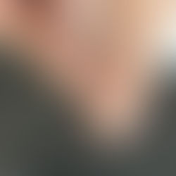 Why Mechanical Predictability Matters in Nail Bracing Systems