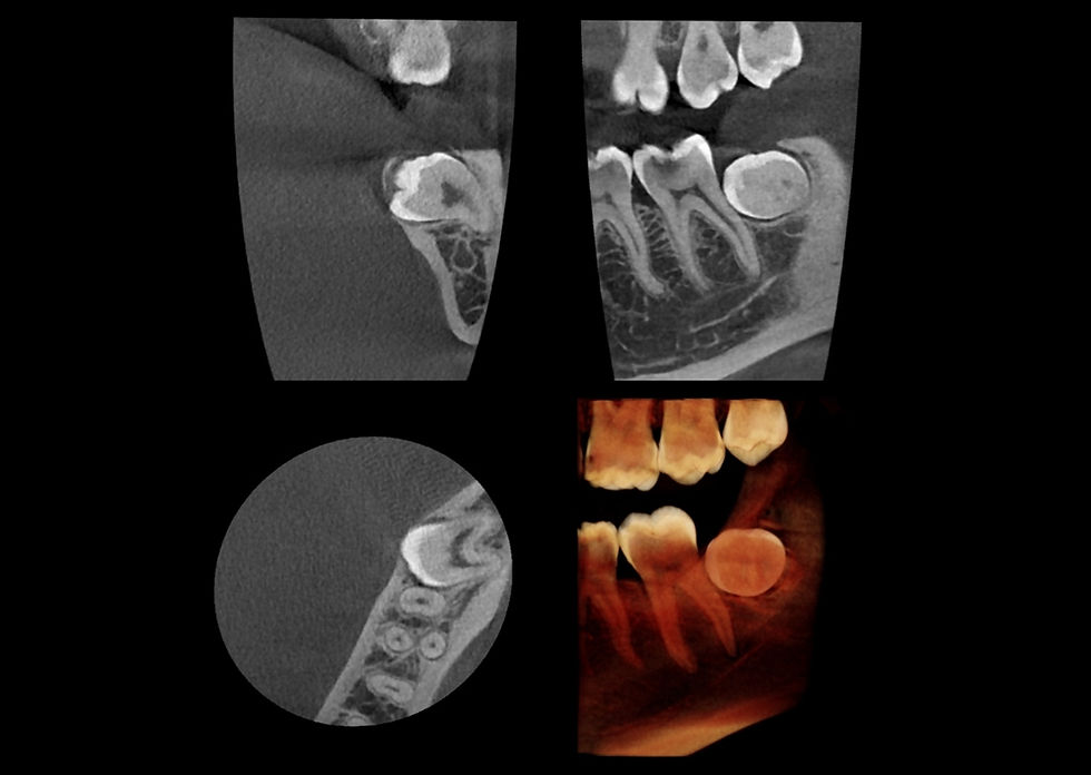 Thumbnail: Papaya 3D Premium Ceph CBCT