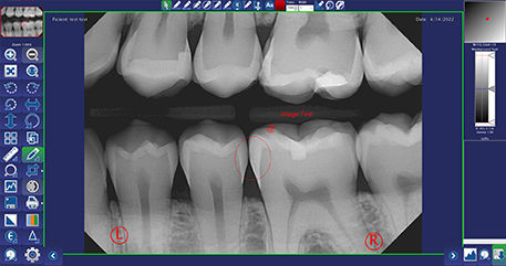 Thumbnail: QUICKVIEW Dental Imaging Software (Server +1 Workstation)