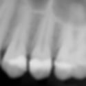 Thumbnail: QUICKRAY PRO Size 2 Dental Sensor (with Uni-Verse-All Kit)