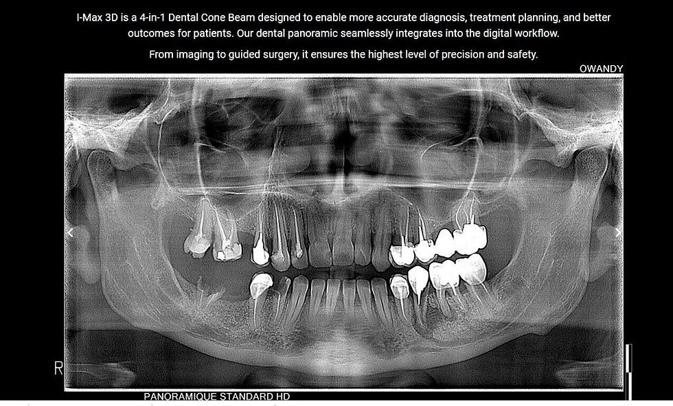 Thumbnail: CBCT iMax CEPH 3D