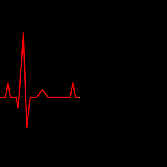 Cardiac monitor of a healthy heart.