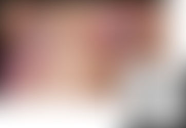 5 Tips on Monkeypox Prevention for Ambulatory Surgery Centers