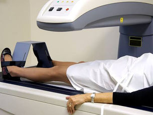 Osteoporosis Screening