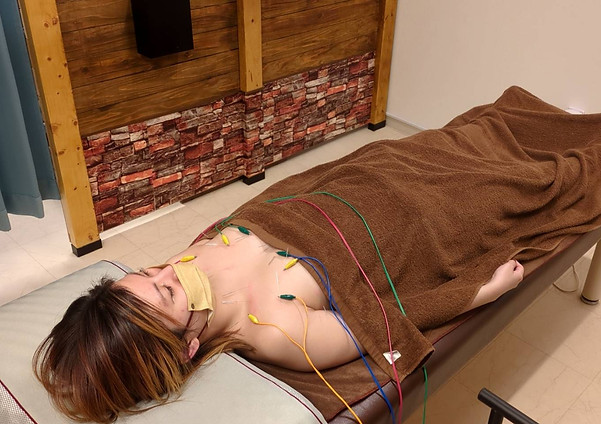 バストアップ鍼の施術を受ける女性