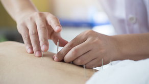 Does Acupuncture Help Sciatica? What to Know