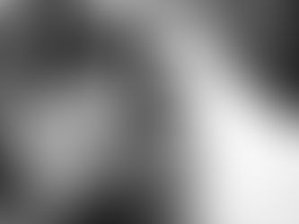 Women getting Deluxe Hydrabrasion Treatment 