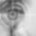 Laser Vision Correction