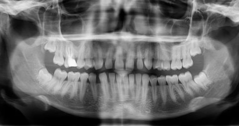 dientes.jpg