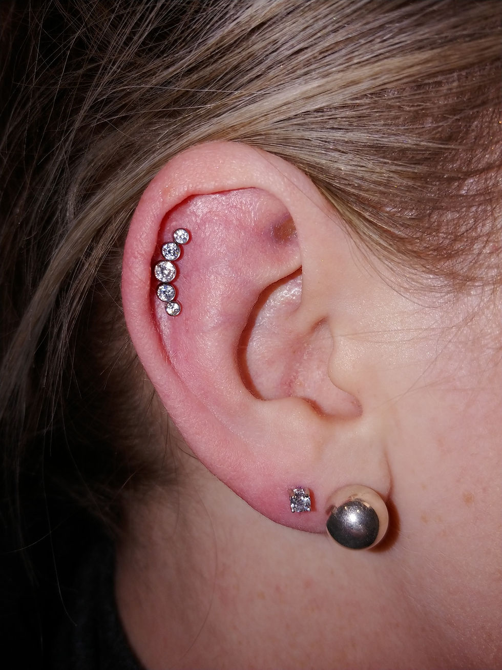 Cartilage/Helix