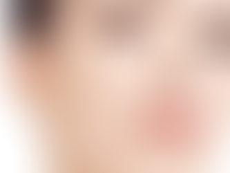 What Is an 8-Point Injection Face Lift (Liquid Facelift)?