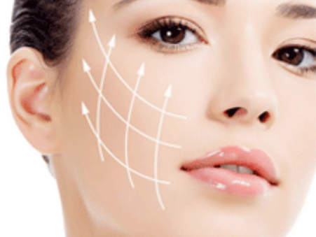 What Is an 8-Point Injection Face Lift (Liquid Facelift)?