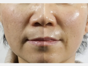 Customized Facials: Tailoring Skincare to Your Unique Needs