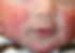 Pediatric dermatology