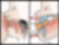 Position de la langue allaitement maternel vs biberon