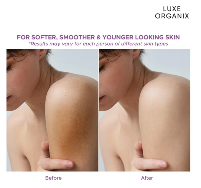 Thumbnail: Luxe Organix Niacinamide + Retinol Cloud Soap 3 x 80g