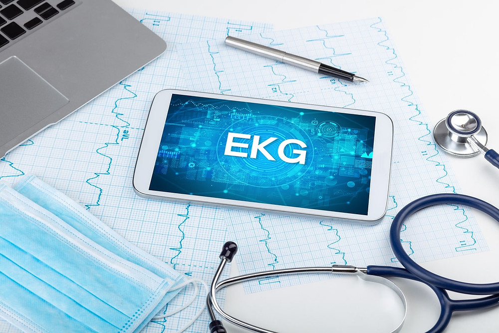 cell phone on top of an ekg graph